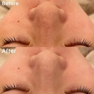 ✨美肌水光✨ アトリエリュバンのエステ・リラクイメージ