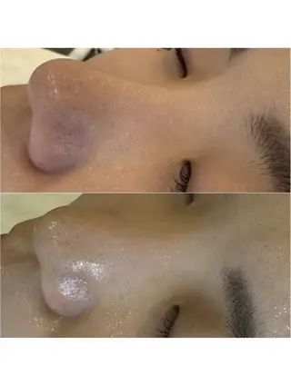 ホワイトニングサロン EARTH目黒店のその他イメージ