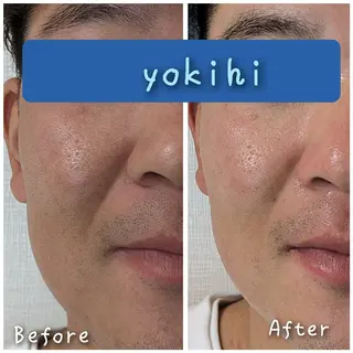 自然由来スキンケア/ 肌質改善/まつパのエステ・リラクイメージ