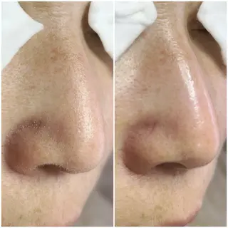 毛穴洗浄専門店/ 泉佐野/oluoluのエステ・リラクイメージ