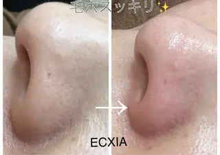 ECXIA 【エクシア】のエステ・リラクイメージ