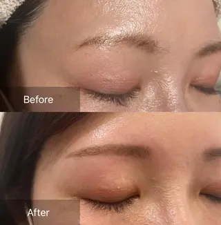 アイブロウ for woman所属・森 美優のエステ・リラクイメージ