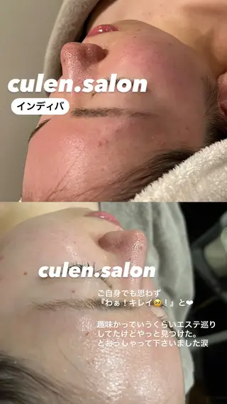 【天神】毛穴・インデ ィバ・ボディケアのエステ・リラクイメージ