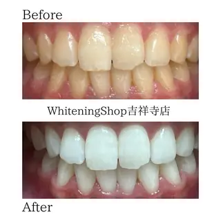 ホワイトニング ショップ吉祥寺店のエステ・リラクイメージ