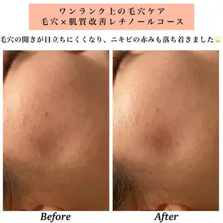 Bellesthe (ベルエステ)のエステ・リラクイメージ