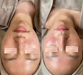 山下 綾乃のエステ・リラクイメージ