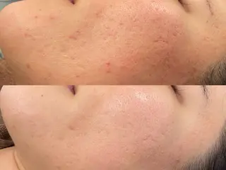 🌈fein.トータ ルビューティー🌈のマツエク・マツパデザイン