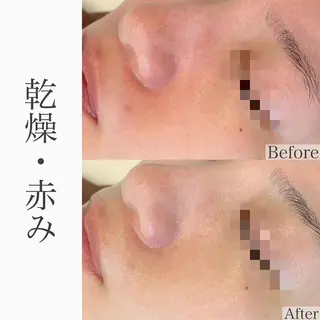 ハーブピーリング専門 BIOEL横浜のエステ・リラクイメージ