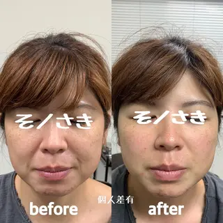 そノさき所属・大阪のシーサー🦁 島袋のエステ・リラクイメージ