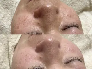 アイブロウ&フェイシャルサロンa‘lm所属・WAX脱毛/肌質改善 眉毛とお肌のサロンのエステ・リラクイメージ