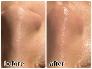 Gemini 　MIKIのエステ・リラクイメージ