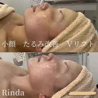 ブライダル痩身×脱毛 尼崎駅前サロンのエステ・リラクイメージ