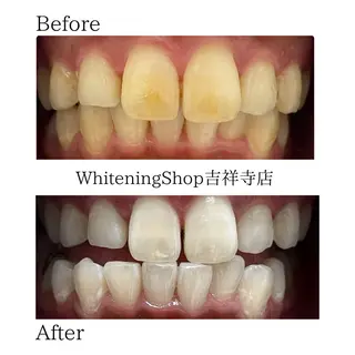 ホワイトニング ショップ吉祥寺店のエステ・リラクイメージ