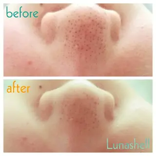 Lunashell所属・オーナー 竹崎のエステ・リラクイメージ