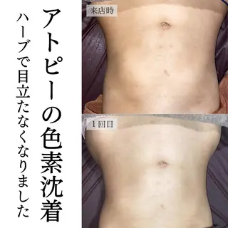 ハーブピーリング・毛穴ケア専門サロンSalon de LENA所属・ハーブピーリング 専門店/名古屋駅前店のエステ・リラクイメージ