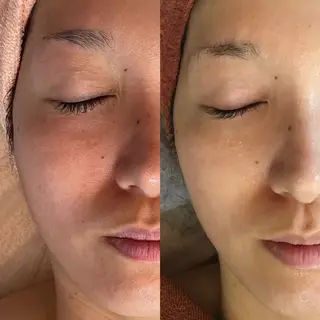 Bébé×DiDiA 野々市市役所前店のエステ・リラクイメージ