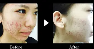 マツエク・マツパ メンズ ロング ショート ミディアム カラー キッズ パーマ セミロング ヘアアレンジ ネイル 次世代まつげパーマは 『リベル名古屋』のマツエク・マツパデザイン