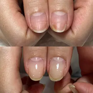 ネイル 自爪育成・巻き爪 補正講師　津蔵のネイルデザイン