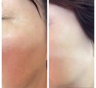 FLEUR大阪・美容 整体・痩身・小顔のエステ・リラクイメージ