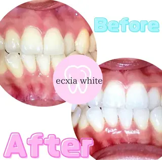 ecxia新宿西口店所属・セルフホワイトニング エクシア新宿西口店のその他イメージ