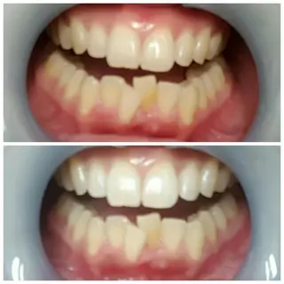 ネイリスト riiisaのネイルデザイン