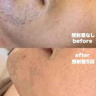 美肌コラーゲン脱毛SINCERITE【サンセリテ】所属・瀬野 のぞみのエステ・リラクイメージ