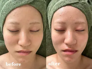 【肌質改善サロン】 リーフィアのエステ・リラクイメージ