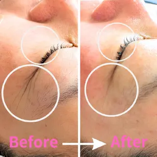 自然由来スキンケア/ 肌質改善/まつパのエステ・リラクイメージ