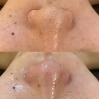 BELCIA福岡店　récolte de BELCIA（レコルトデベルシア）所属・BELCIA福岡店 レコルトデベルシアのエステ・リラクイメージ