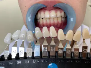 メンズ 217whitening  room所属・217 ホワイトニングルームのエステ・リラクイメージ