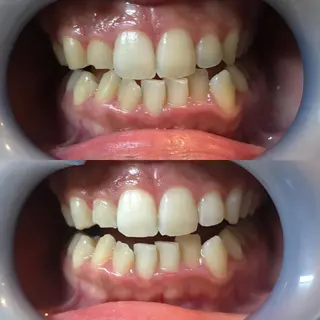 LBSホワイトニング 新宿店💝店長熊倉のその他イメージ