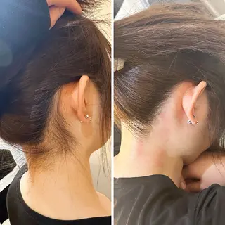 うなじ脱毛/美肌脱毛 LABELのエステ・リラクイメージ