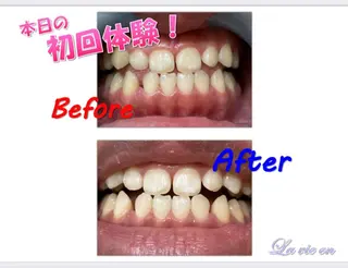 セルフホワイトニングサロン　ラヴィアン所属・ホワイトニングサロン La vie enのその他イメージ