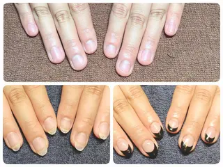 ネイル 深爪矯正/爪育成ケア manie nailのネイルデザイン