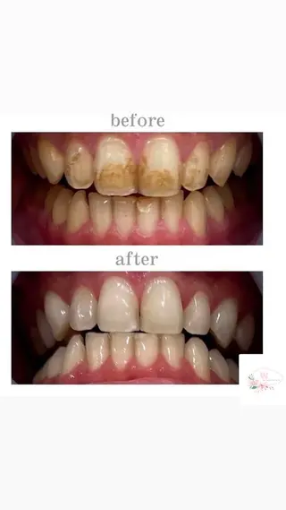 ホワイトニングショップ本厚木所属・ホワイトニング ショップ本厚木のその他イメージ