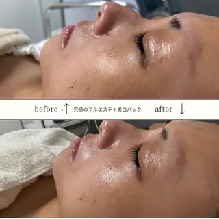 skinLabo所属・saya Mのエステ・リラクイメージ