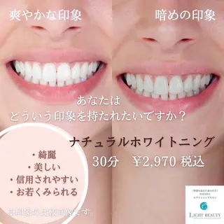 ショート ヘアアレンジ ネイル マツエク・マツパ メンズ カラー パーマ アイブロウ キッズ ライトビューティー 銀座本店のエステ・リラクイメージ