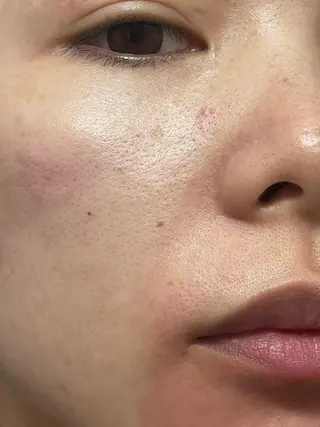 脱毛SALON RaYNiCKのエステ・リラクイメージ