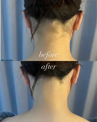 うなじ脱毛/美肌脱毛 LABELのエステ・リラクイメージ