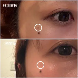 MORE BEAUTY ESTHE 本通り店所属・【シミ・シワ専門店】 山本 藍美のエステ・リラクイメージ