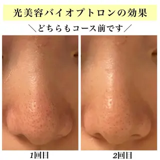 Bellesthe (ベルエステ)のエステ・リラクイメージ