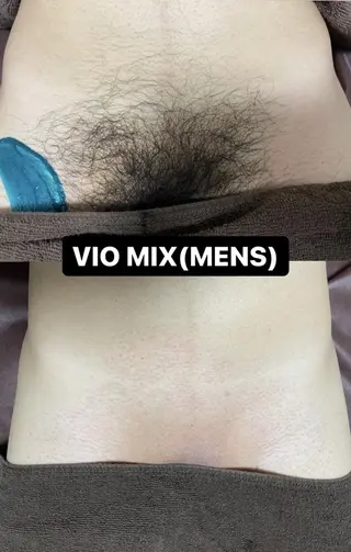 メンズ Epina 千葉店 【エピナ】のエステ・リラクイメージ