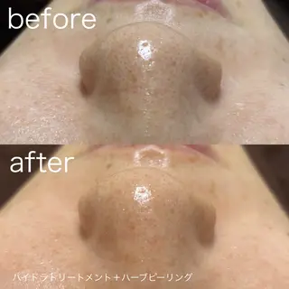 lulularico Yuのエステ・リラクイメージ