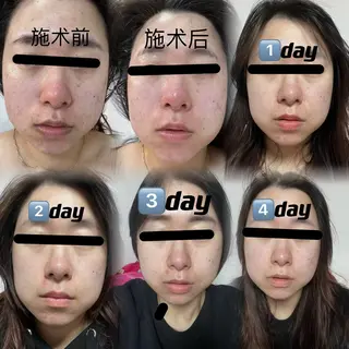 U・mi ユキのマツエク・マツパデザイン