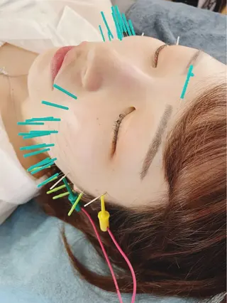 小顔美容鍼専門サロン 渋谷YZのエステ・リラクイメージ