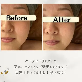 お肌と歯のサロン　Sona Mior所属・藤井 ののみのエステ・リラクイメージ