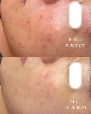BELLIS HUIT所属・肌質改善｜体質改善ꕤ BELLISHUITのエステ・リラクイメージ