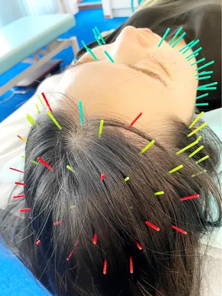 小顔美容鍼専門サロン 渋谷YZのエステ・リラクイメージ