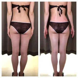 小顔・痩身専門店 Sunao所属・小顔.足痩せ整体 痩身天六Sunaoのその他イメージ