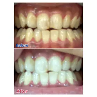 MBEAUTYSALON 千葉店・京成大久保所属・Melty 輝のその他イメージ